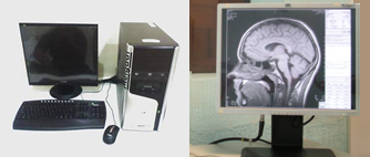 Teleradiología y Monitores